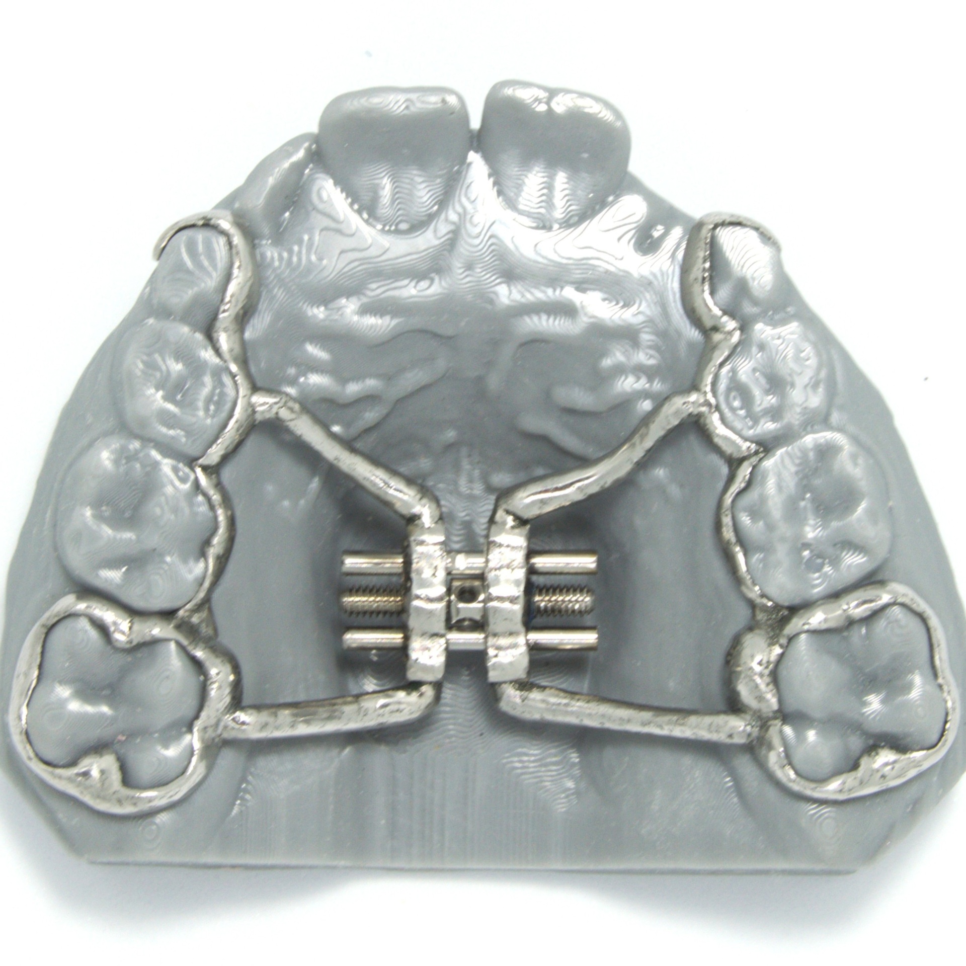 Aparelho ortodôntico em metal